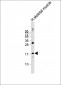 ND4L Antibody (C-term)